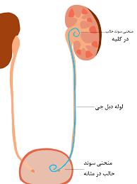 مراقبت بعدازخروج دبل جي